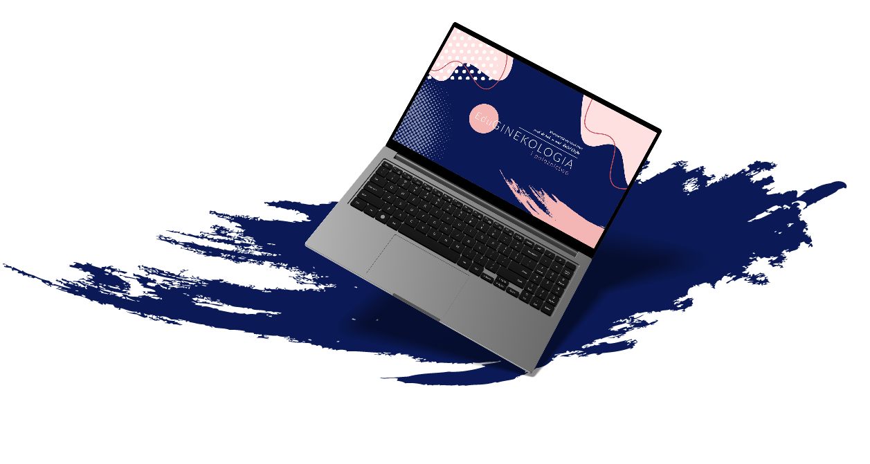 laptop2 EduGinekologia - laptop2